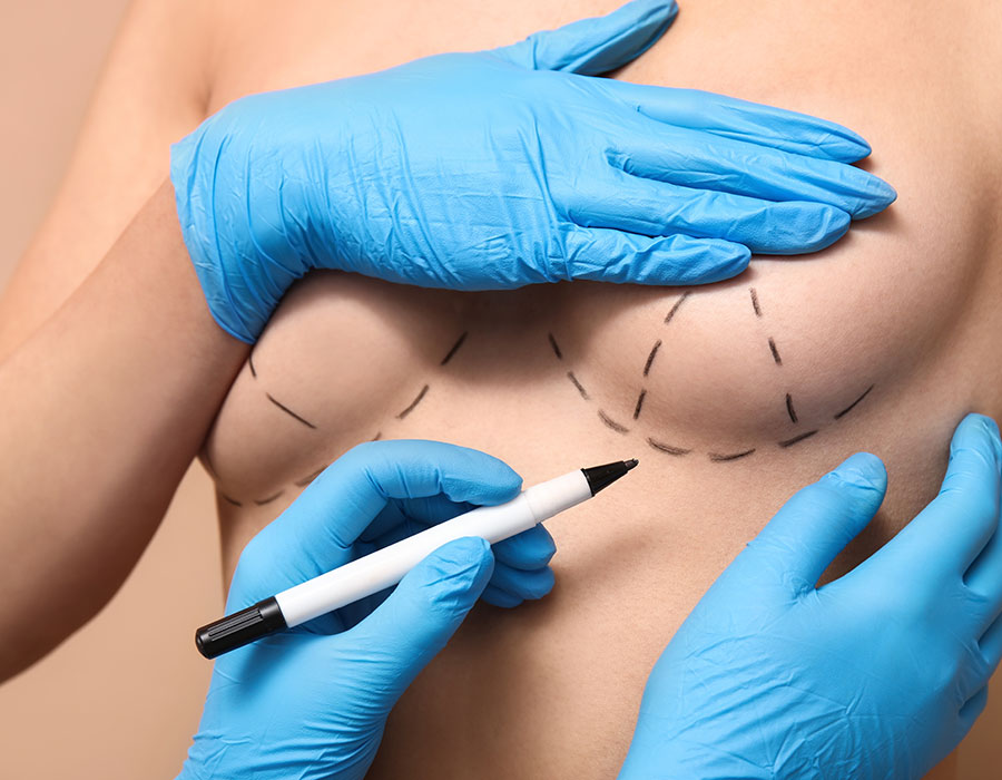 operacion-estetica-pechos